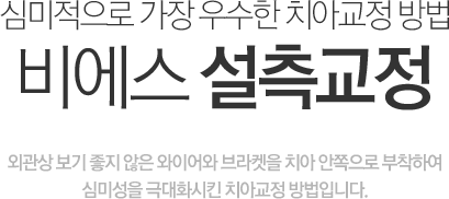 비에스 설측교정